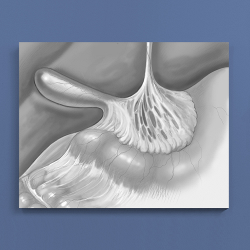 CONNY HENGERERHENKEL illustration medical